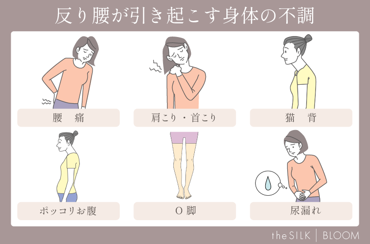 反り腰が引き起こす体の不調